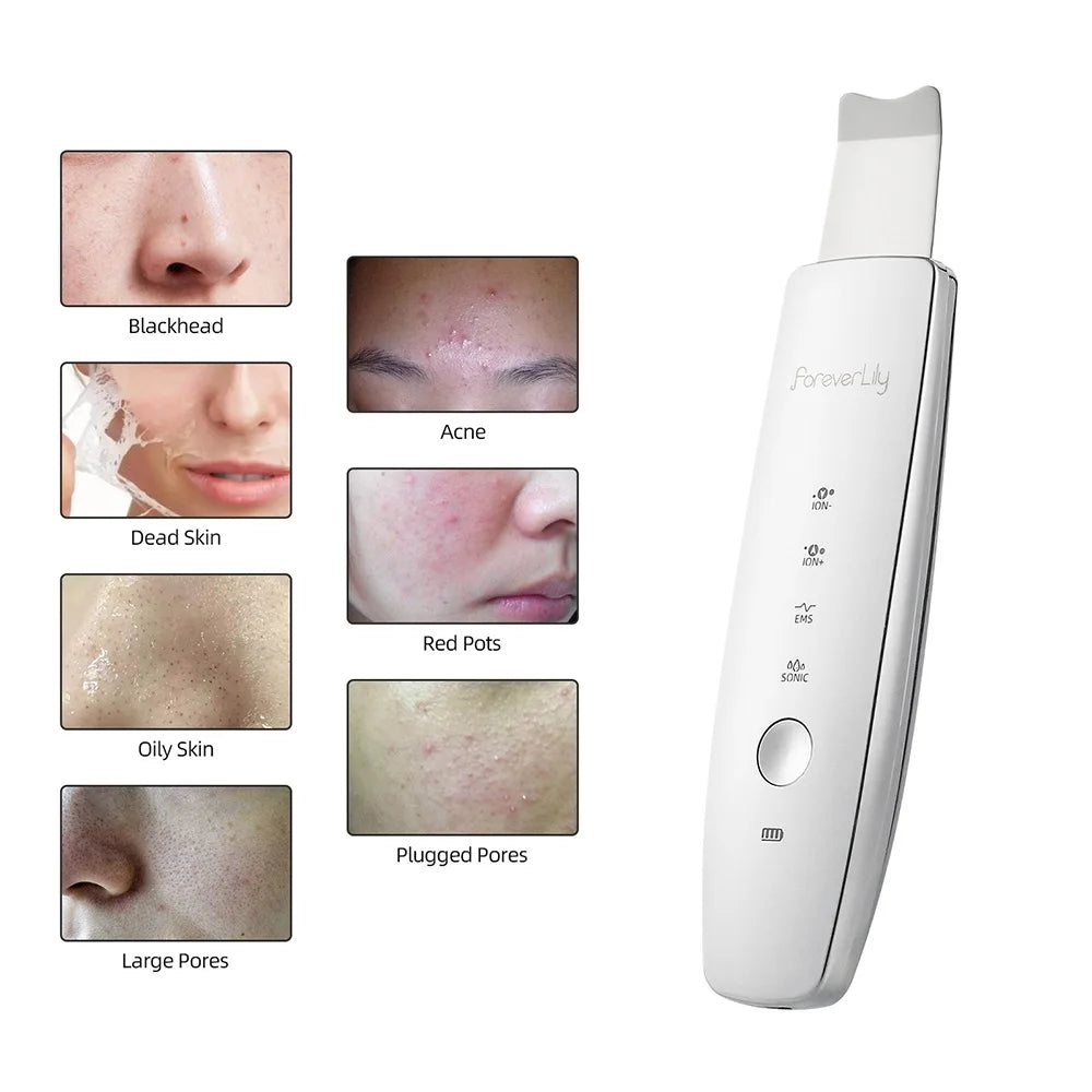 Ultrasound Facial Scrubber Shovel ION LED Light Face EMS Facial Peeling Pore Clean Removal Blackhead Cleansing Skin Care Tool