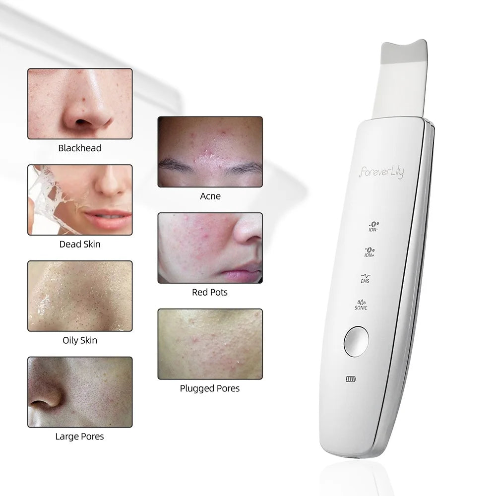 Ultrasound Facial Scrubber Shovel ION LED Light Face EMS Facial Peeling Pore Clean Removal Blackhead Cleansing Skin Care Tool