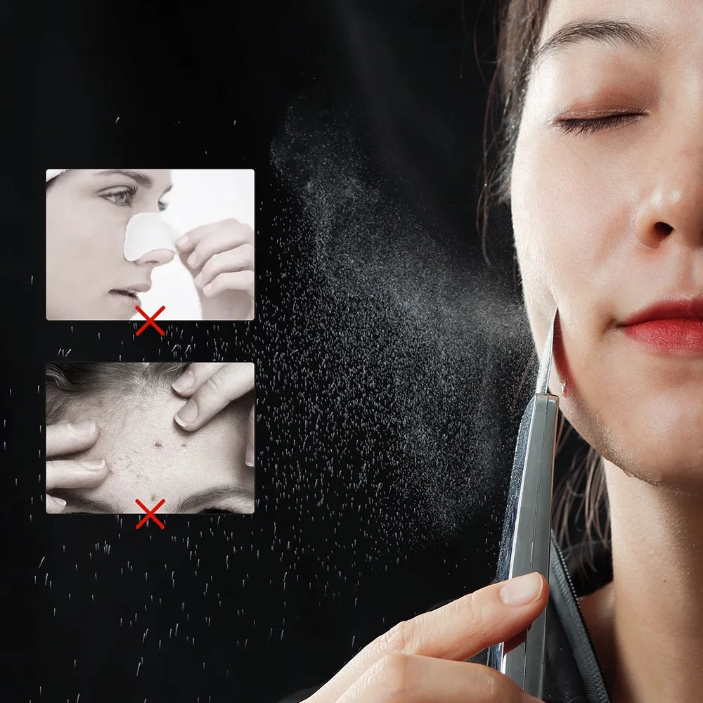 Ultrasound Facial Scrubber Shovel ION LED Light Face EMS Facial Peeling Pore Clean Removal Blackhead Cleansing Skin Care Tool