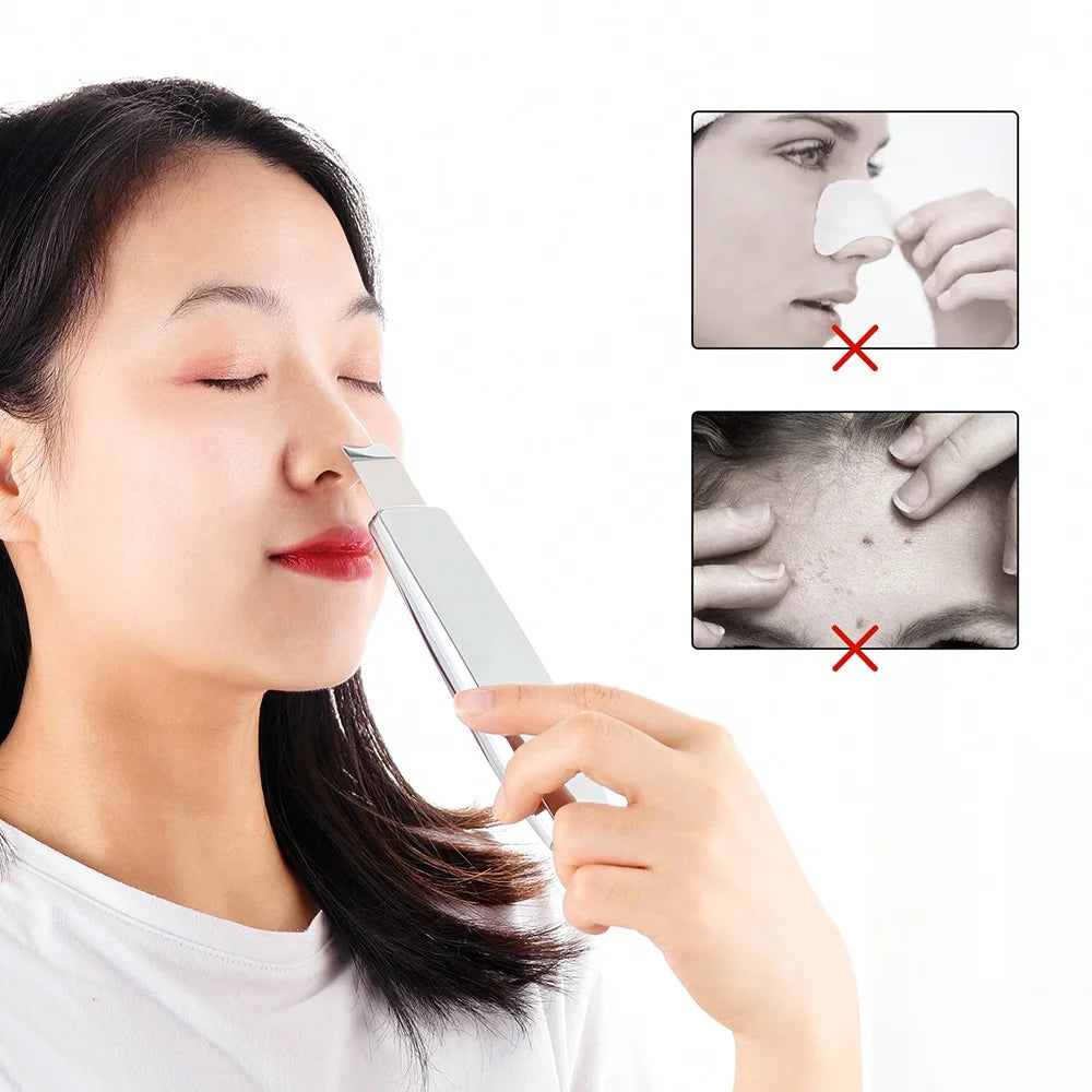 Ultrasound Facial Scrubber Shovel ION LED Light Face EMS Facial Peeling Pore Clean Removal Blackhead Cleansing Skin Care Tool