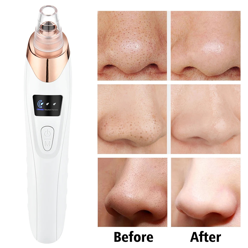 Blackhead Remover Pore Acne Pimple Removal Face T Zone Nose Cleaner Vacuum Suction Facial Diamond Beauty Clean Skin Oil Dirty