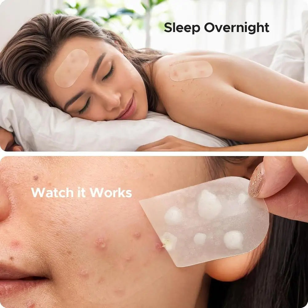 Hydrocolloid Patch Acne Invisible Pimple Removal Multi-shape Mixing  Full Face Pimple Patches Beauty Makeup Face Care