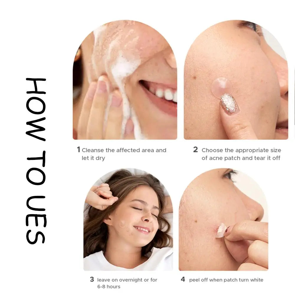 Hydrocolloid Patch Acne Invisible Pimple Removal Multi-shape Mixing  Full Face Pimple Patches Beauty Makeup Face Care