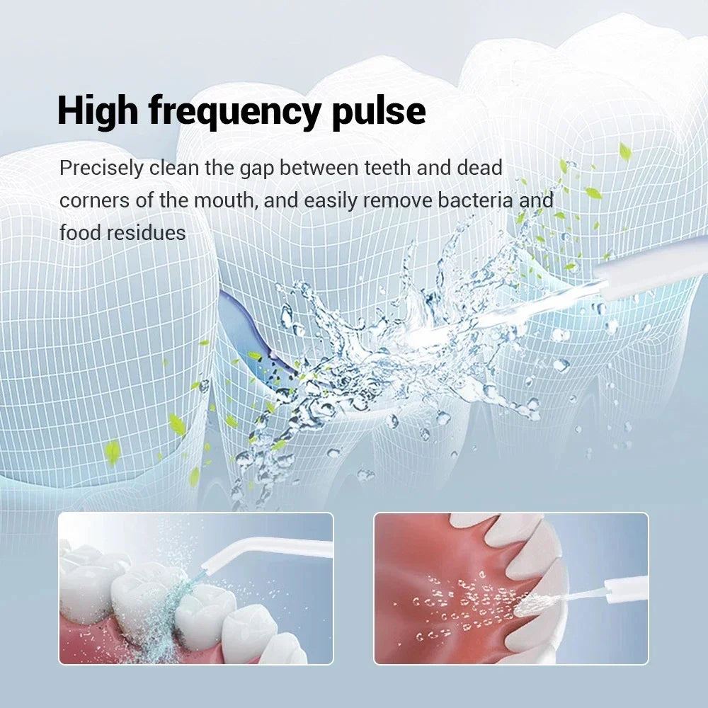 TINSOL Electric Tooth Flosser High Pressure Jet Flosser Electric Toothbrush Whitening USB Rechargeable Gum Care Jet Scaler