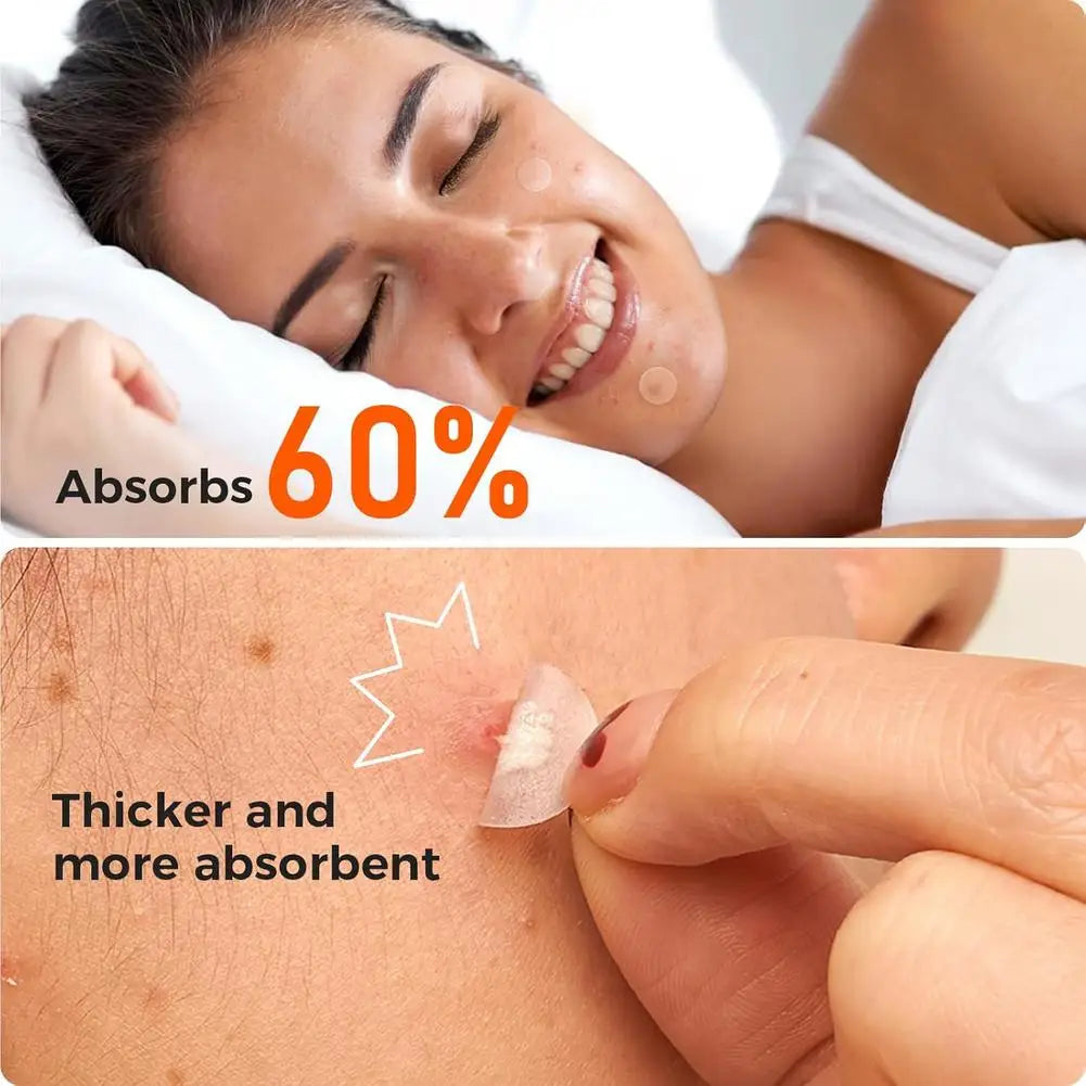 Hydrocolloid Patch Acne Invisible Pimple Removal Multi-shape Mixing  Full Face Pimple Patches Beauty Makeup Face Care