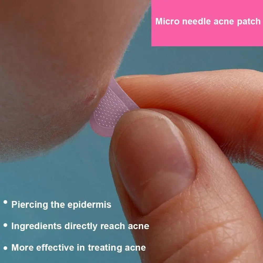 1set Soluble Microneedle Hydrocolloid Acne Patch Invisible Breathable Acne Patch Available Day And Night Skin Care Repair Patch