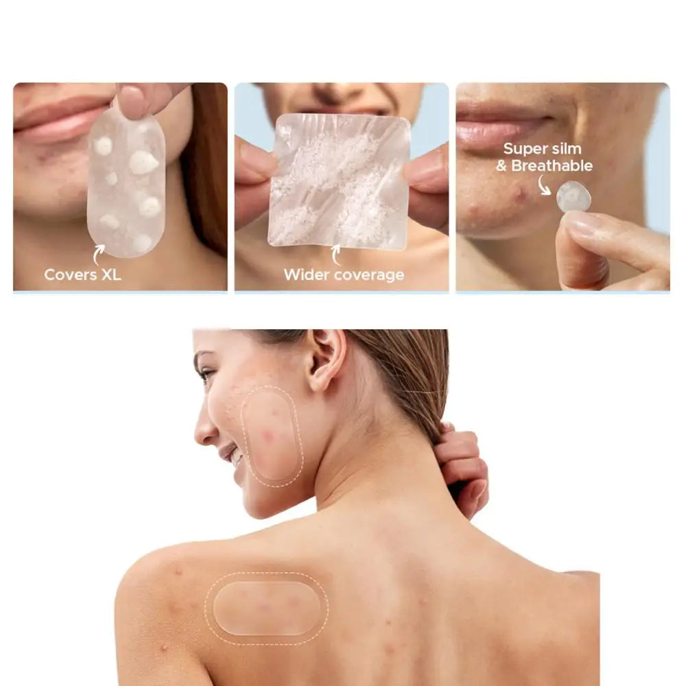 Hydrocolloid Patch Acne Invisible Pimple Removal Multi-shape Mixing  Full Face Pimple Patches Beauty Makeup Face Care