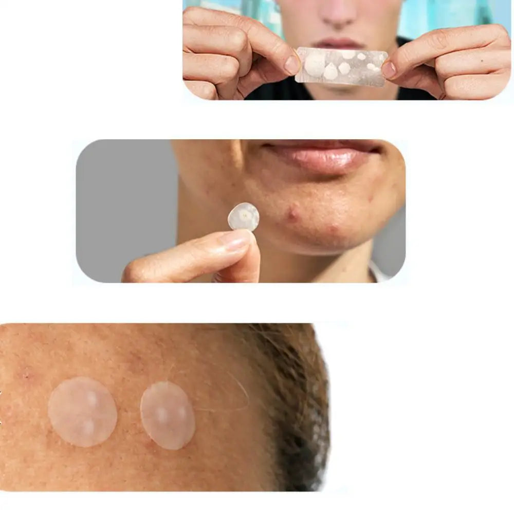 Hydrocolloid Patch Acne Invisible Pimple Removal Multi-shape Mixing  Full Face Pimple Patches Beauty Makeup Face Care